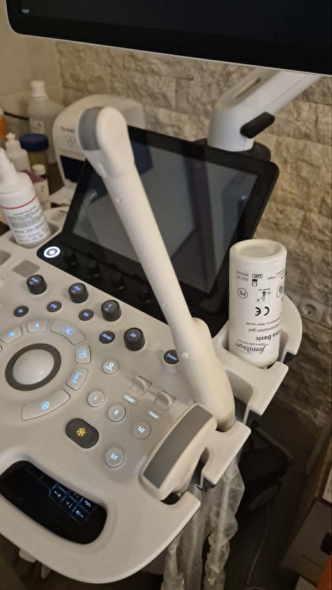 Használt HS40 ultrahang készülék két vizsgálófejjel szülészeti, nőgyógyászati célra Használt HS40 ultrahang készülék két vizsgálófejjel szülészeti, nőgyógyászati célra