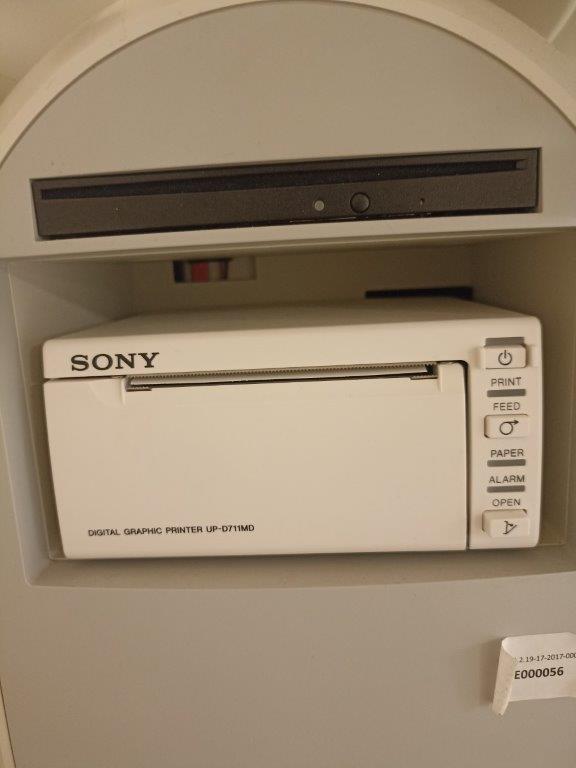 Használt Esaote MyLAb X5 ultrahang készülék Sony fekete-fehér hőnyomtatóval Használt Esaote MyLAb X5 ultrahang készülék Sony fekete-fehér hőnyomtatóval