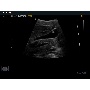 MySono U6 DEMO kép1